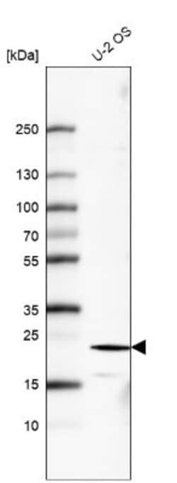 FGF-21 Antibody (CL6491), Novus Biologicals:Antibodies:Primary Antibodies